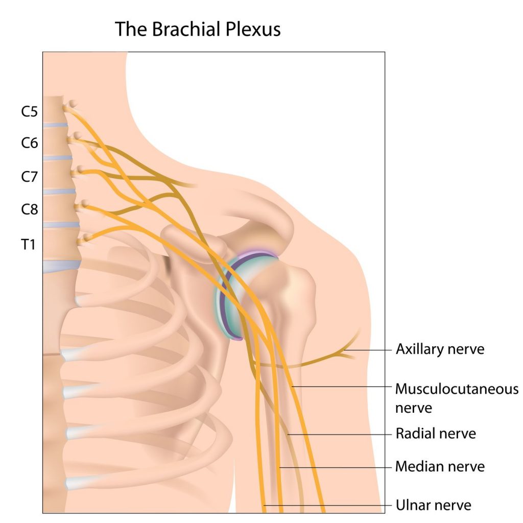 Brachial Neuritis Vaccine Litigation Attorneys - Schiffmacher Cinelli ...