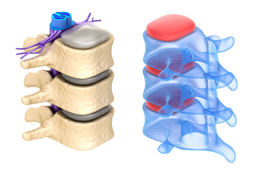 Transverse Myelitis